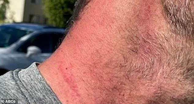 AI-Generated Texts Fuel Nurse's Nightmare, Prompting Calls for Tech Regulation