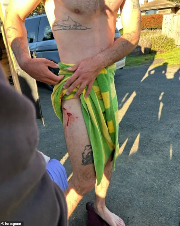 Exclusive: Surfer's Narrow Escape from Rare Shark Encounter in California