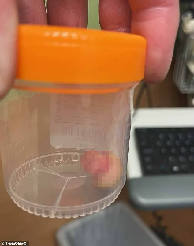 Minneapolis Protests Erupt After Federal Agents' Fatal Shooting of Nurse and HSI Officer Injured in Escalating Violence