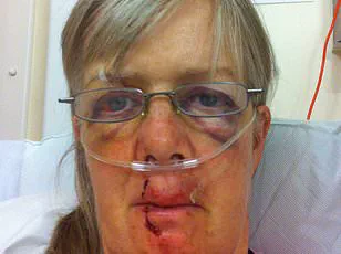 Dog Walker Rescued After Hour-Long Stranding in Tree Due to Angry Cow on Isle of Wight