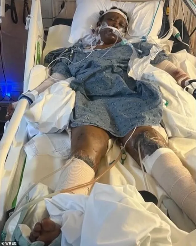 Horrifying Dog Attack in Mississippi Leaves Community in Shock and Sparks Debate Over Animal Control