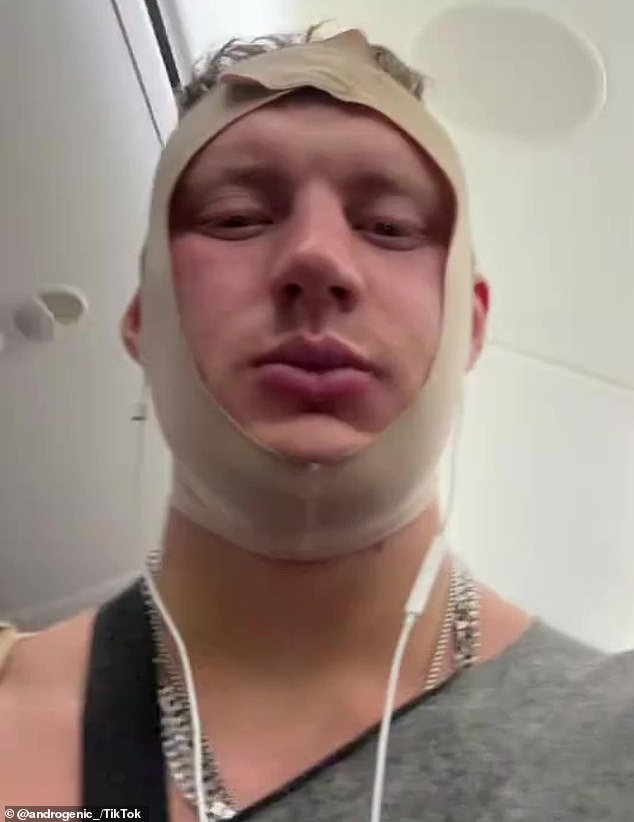 Jetstar removes 'looksmaxxer' after critical condition post-surgery