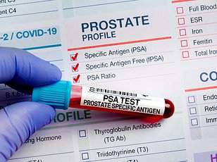 New Map Reveals Deadly Prostate Cancer Hotspots Across America.