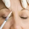 Deadly Threat: The Lethal Power of Botulinum Toxin and Its Neurological Impact