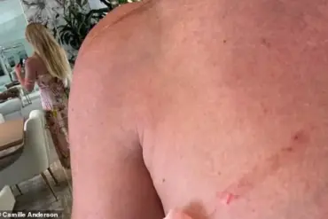 Camille Anderson's Beverly Hills Attack Reignites Urgent Safety Debates in Wealthy Neighborhood