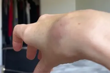 Exclusive Insights: How a TikTok Influencer Exposed Hidden Airline Policies on Disability Assistance